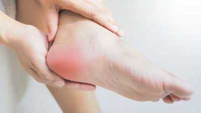 Plantar Fasciitis